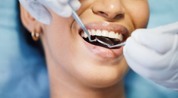 Best Emergency Dental Care for Sports Injuries in White Cloud, MI