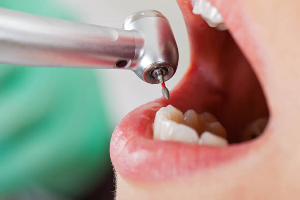 Best Emergency Denture Repair in White Cloud, MI